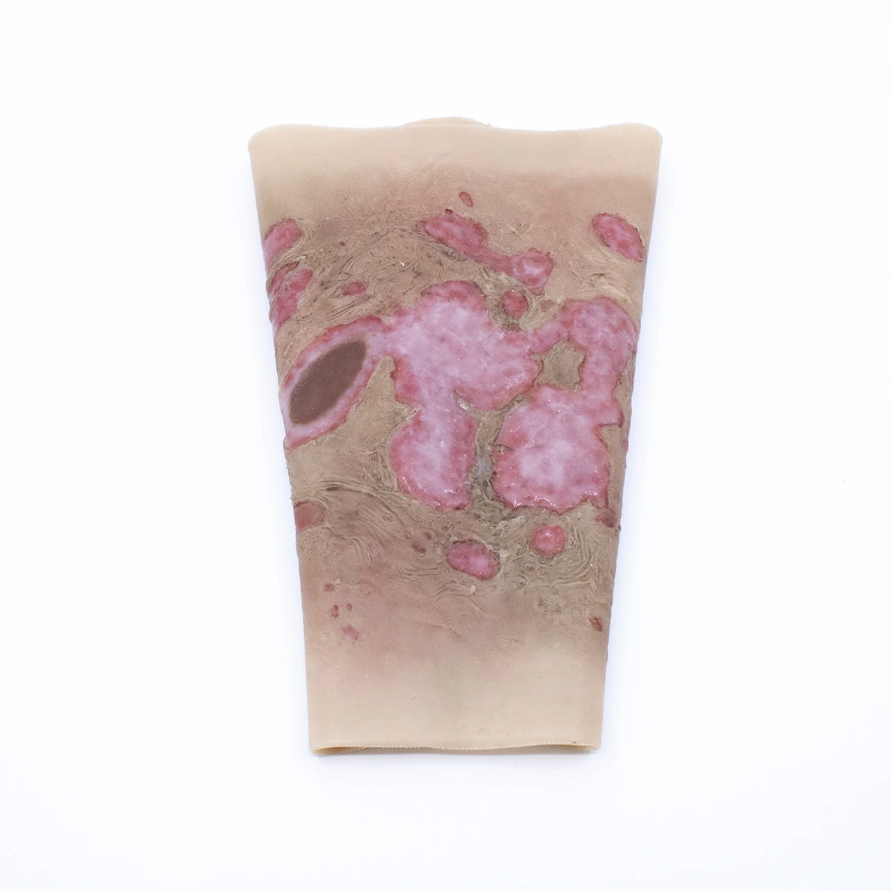 TRAUMASIM Wearable Large Burn - Forearm